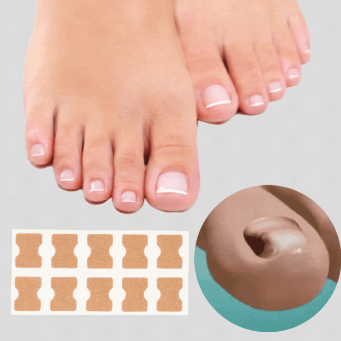 Correction Patches for Beautiful and Healthy Nails