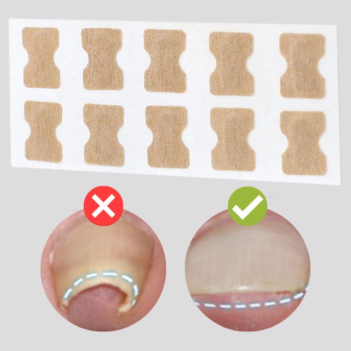 Correction Patches for Beautiful and Healthy Nails