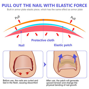 Correction Patches for Beautiful and Healthy Nails